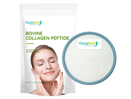 Common extraction methods