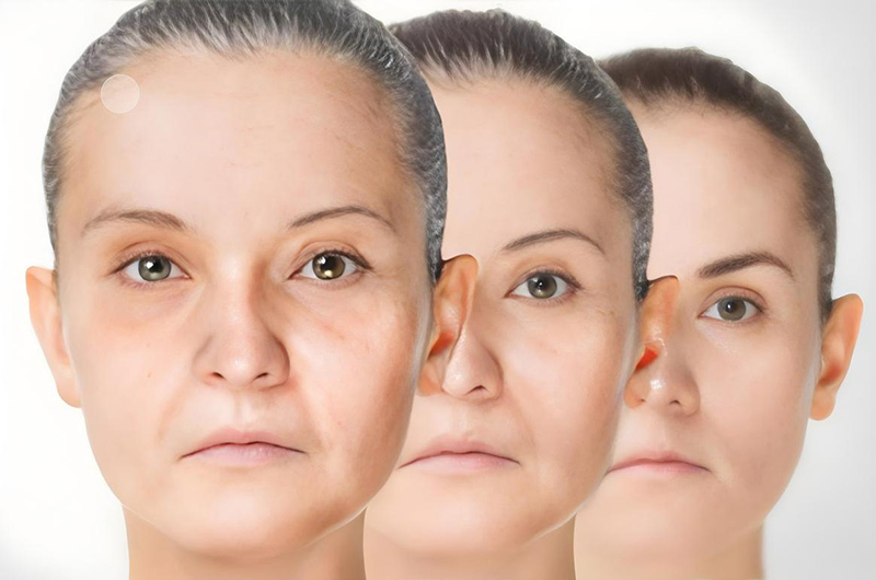 Sensory Characteristics of Echinacea Polyphenols